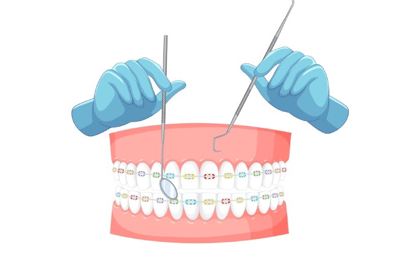 periodontal dentist cookeville tennessee